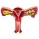 Sistema reproductor femenino modelo anatomico - Utero